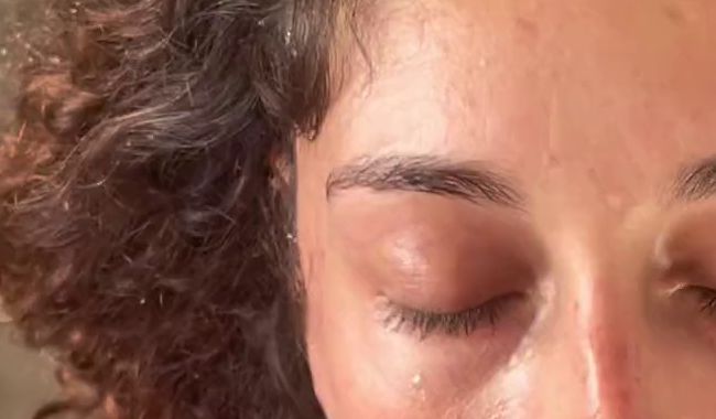 Download: AntonellaVega - OMG ¿HA HECHO UN DESASTRE EN MI CARA? ¿TE GUSTA GESICHTSBEHANDLUNG?