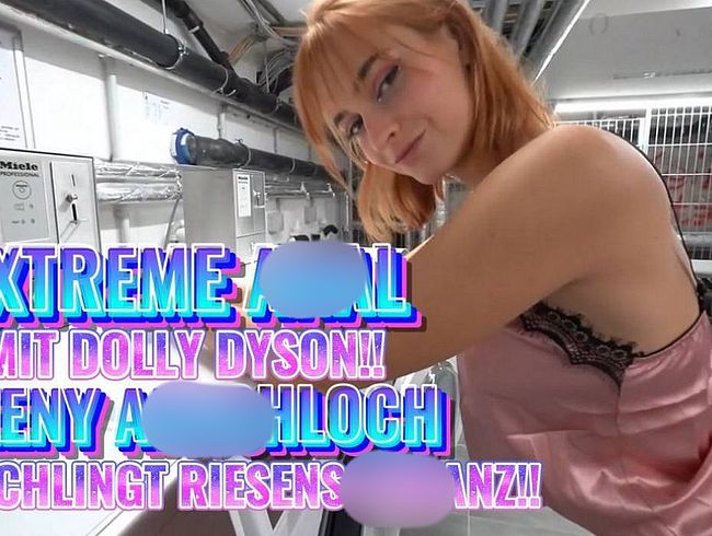 Download: Chris-Liam - EXTREME ANAL TEENY ARSCHLOCH VERSCHLINGT RIESENSCHWANZ