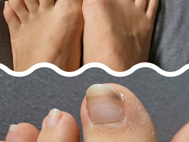 Download: Honey-Bitch - Dringende Pediküre notwendig