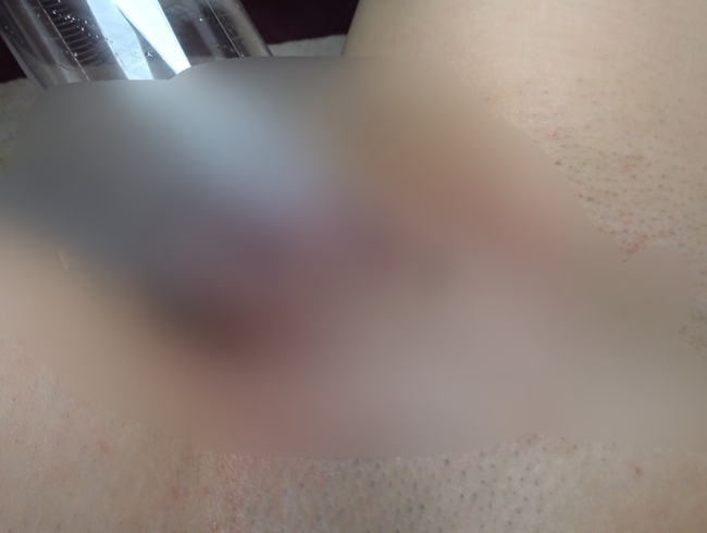 Download: Mia-Love - Aufgepumpte Muschi - Mein erster Versuch