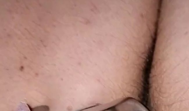 Download: MissNaturPur - Spekulum und NS