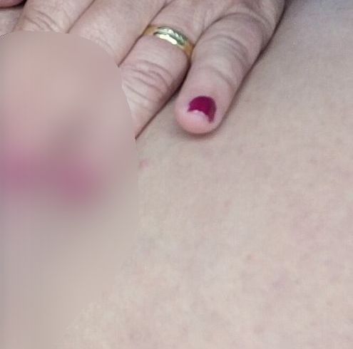 Download: Nikki-Holland - Rosa Falten tief