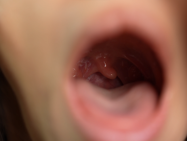 Download: Pantera_Nika - Ich werde Ihnen den Uvula -Fetisch extrem nah zeigen