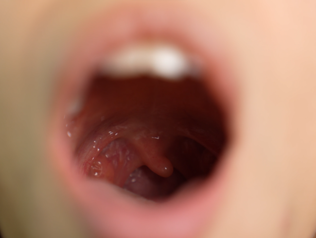 Download: Pantera_Nika - Ich werde Ihnen den Uvula -Fetisch extrem nah zeigen