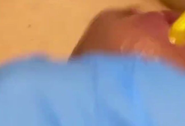 Download: Philantropy - Handjob mit Katheter