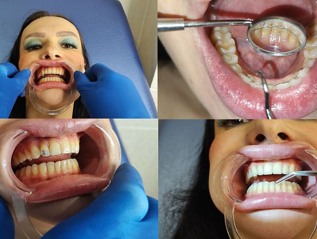 Download: Princess18xxx - Komplette Zahnuntersuchung durch den Zahnarzt, Anbringen von Schmuck