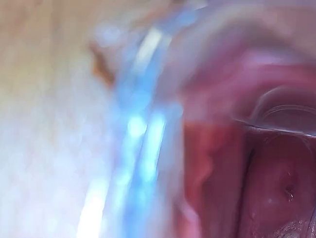 Download: SueVenusN - 2 Clips // Nahaufnahme Spekulum vom ,,Speculum-Live-Treffen“