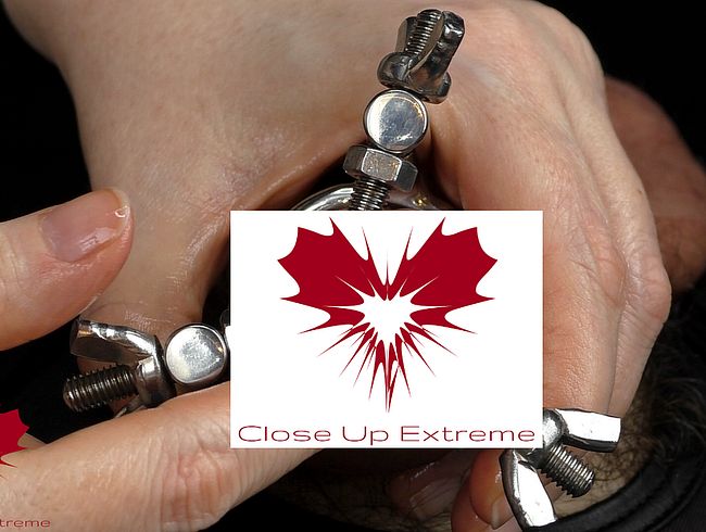 Download: closeupextreme - Dilatation der Loch expandierten Eichel und Spermablockade durch urethrales Einführen des Fingers II